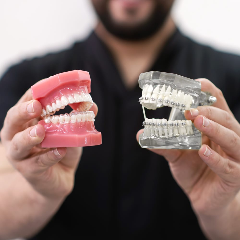 Invisalign Vs. Braces, Grand Rapids Orthodontist