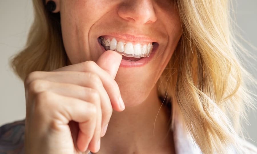 Invisalign Clear Aligners, Grand Rapids Orthodontist